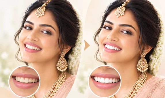 Before and after comparison of a brighter smile after gentle teeth whitening