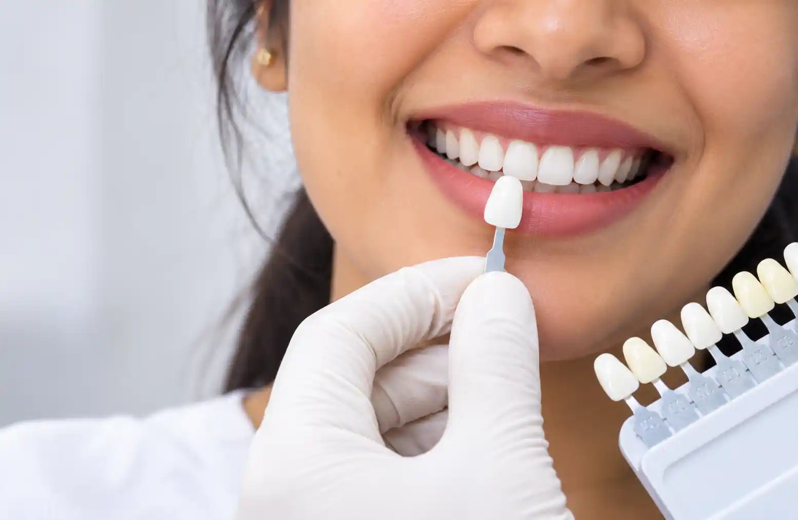 Cosmetic dental work at Radiant 32, Bhowanipore, Kolkata