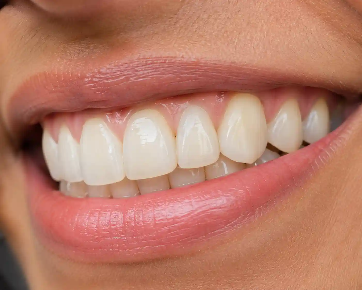 A natural looking result from treatment at Radiant 32, Bhowanipore