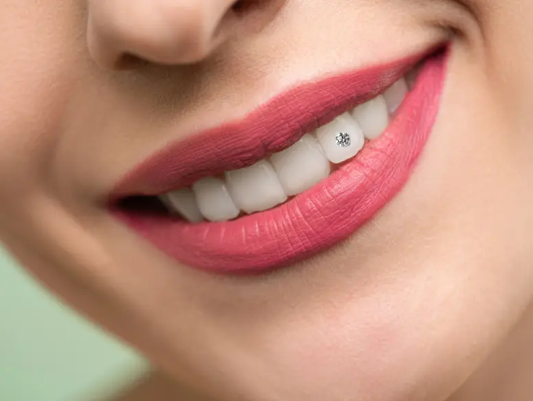 A bright, healthy smile suited to a tooth gem at Radiant 32, Bhowanipore