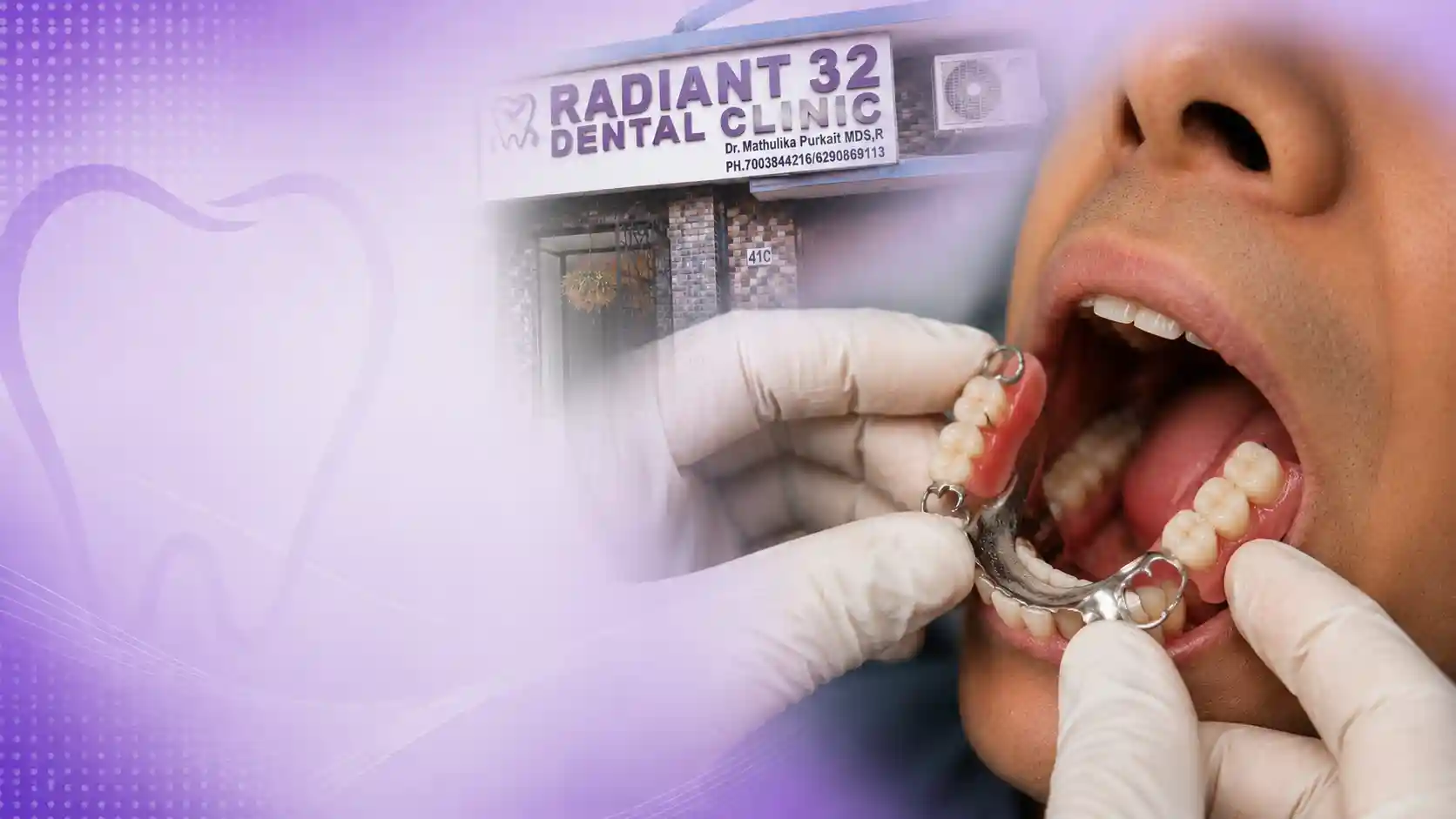 Dentures and partials prepared for fitting at Radiant 32, Bhowanipore
