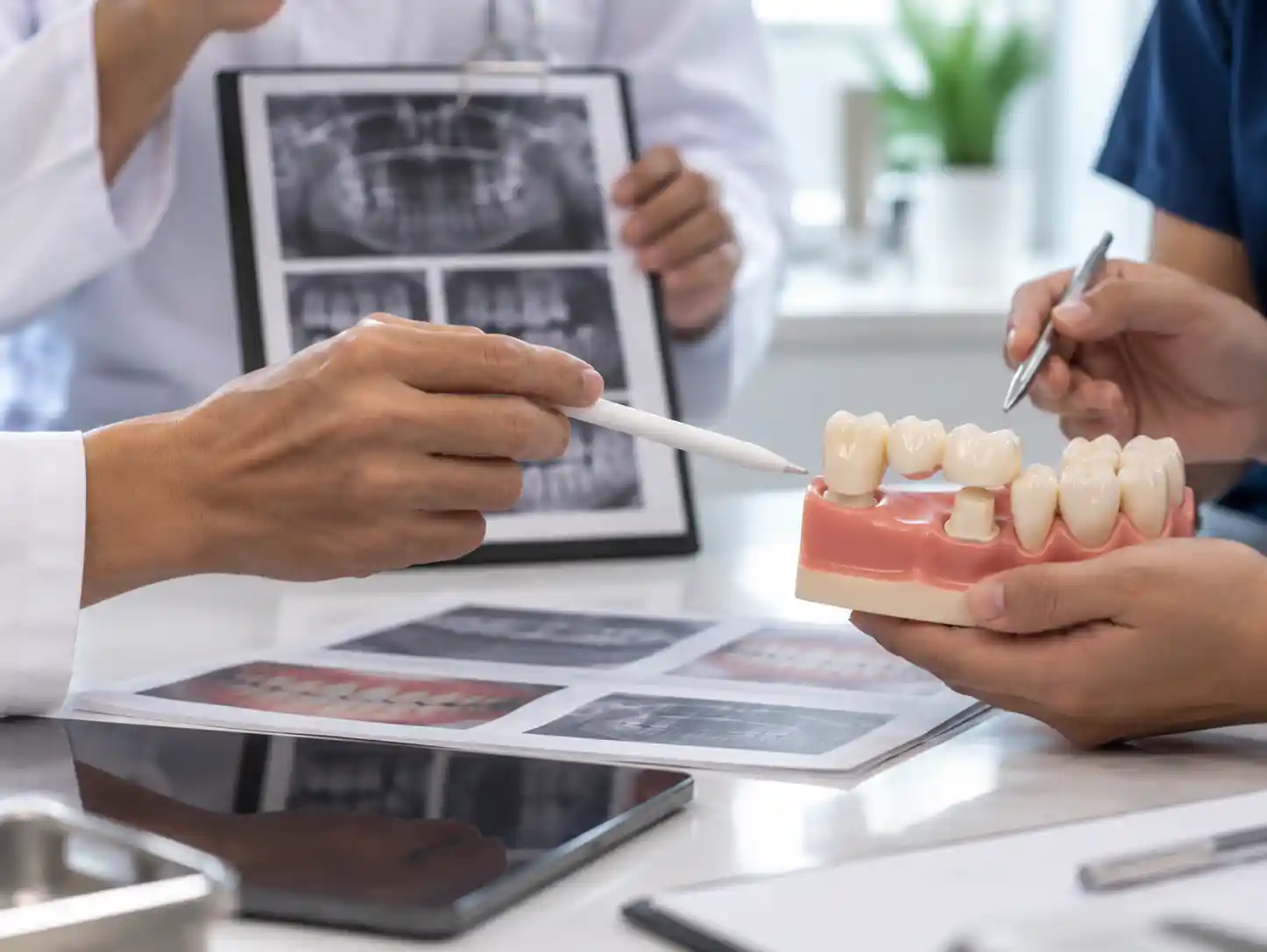 Crowns rebuilt on natural teeth at Radiant 32, Bhowanipore