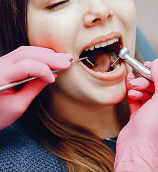 Teeth extraction process